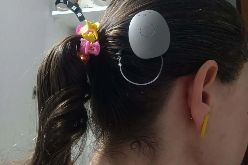 Paraná assume liderança nacional em implantes cocleares pelo SUS Foto: SESA